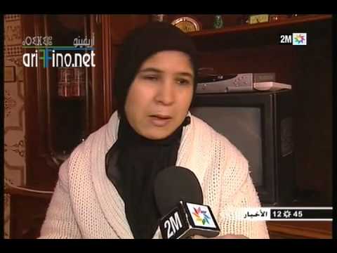 مرض نادر يصيب طفلًا في الناظور